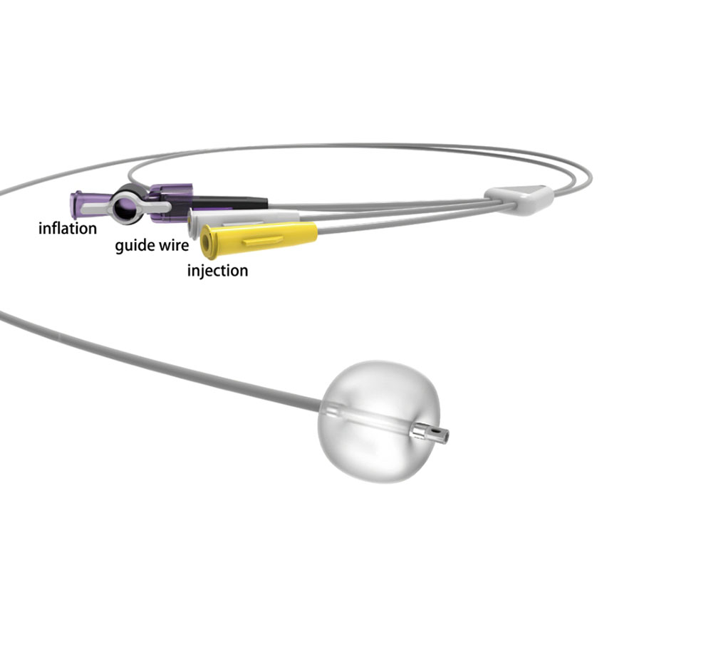 Stone Extraction Balloon
