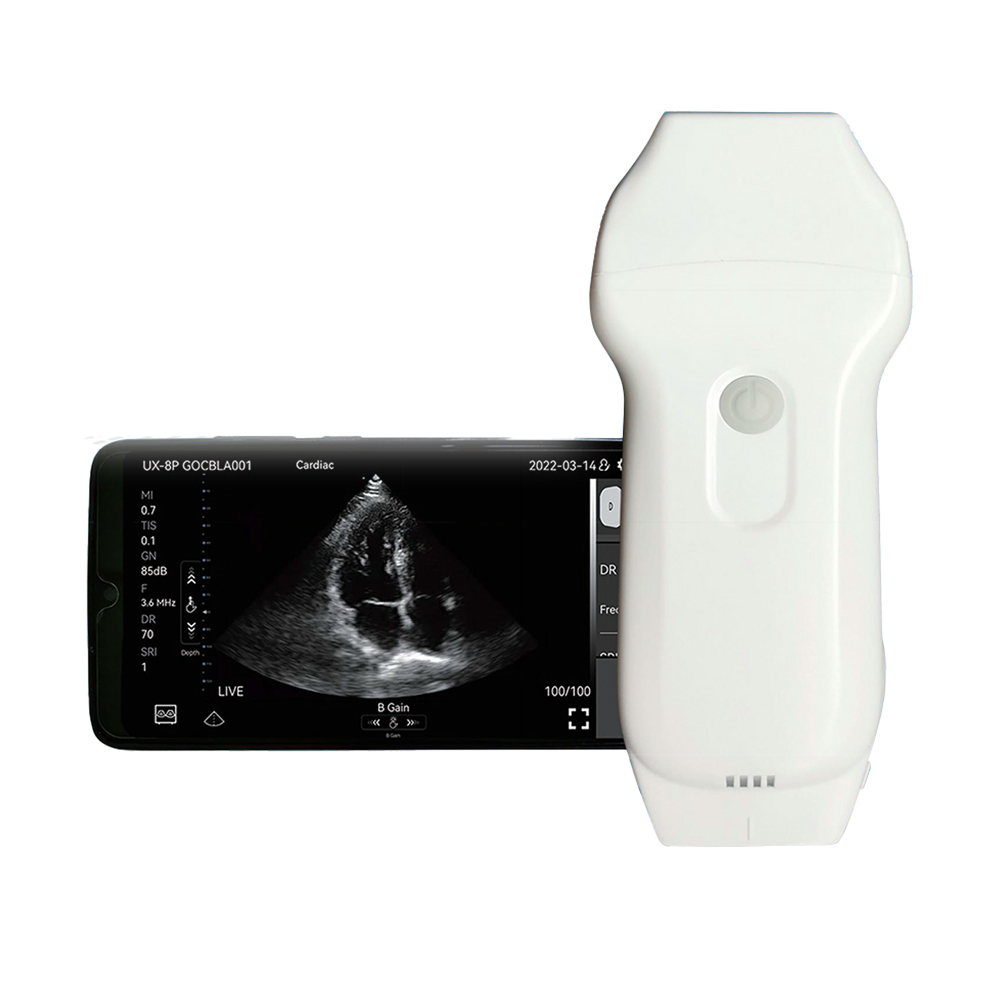 Ultrasound Scanner RK-4CPL